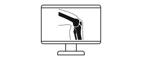 To the page:Bridging the gap in ACL injury prevention with FAME: Field-based Athlete Motion Evaluation and simulation (FAME)